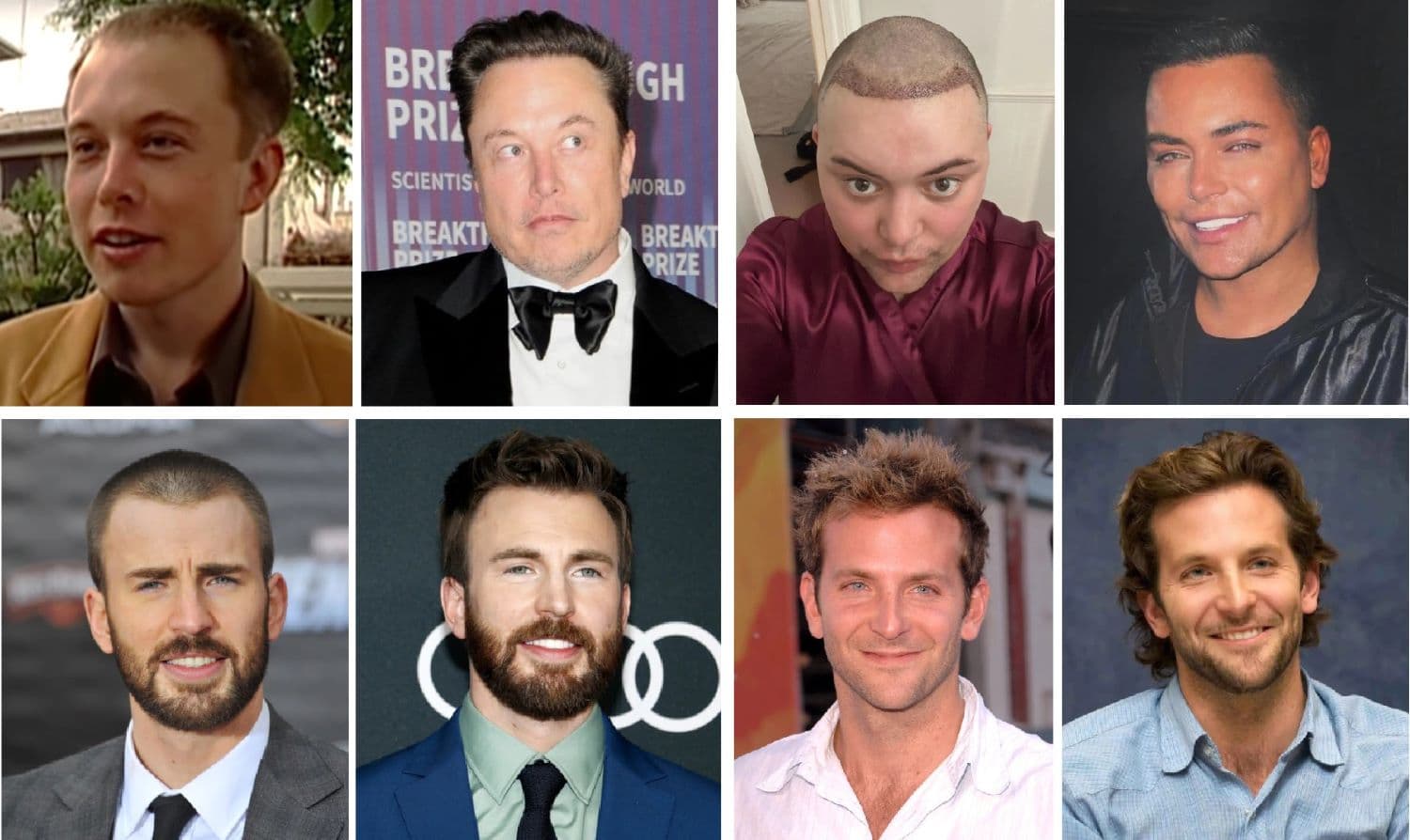 Custom Hair Units for Men in New York